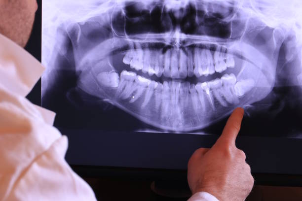 Best Emergency Dental Care for Broken or Chipped Teeth in Etowah, NC
