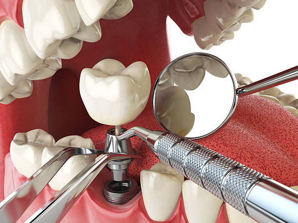 Best Same-Day Emergency Dental Services in Etowah, NC